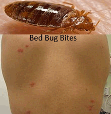 Bed Bugs Bites